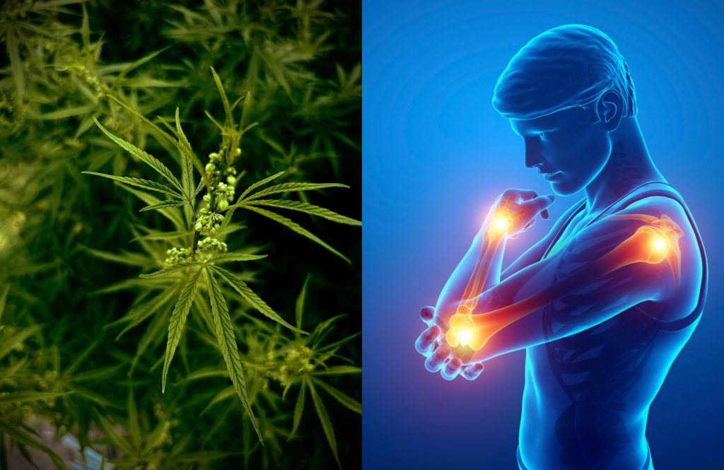 Medical Marijuana for Arthritis Pain