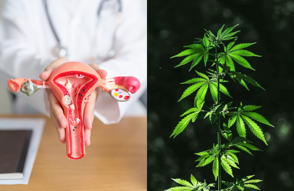 Can Medical Cannabis Help with Ovarian Cyst Pain in Illinois?