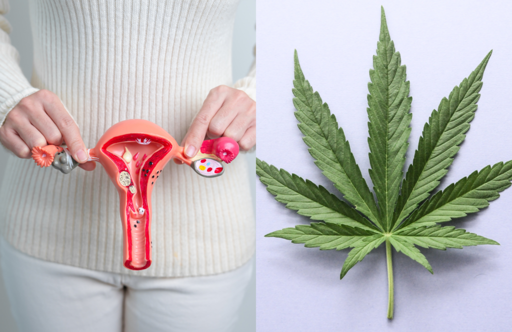 Illinois Medical Marijuana for Fibroids: Eligibility, Relief, and Card Steps